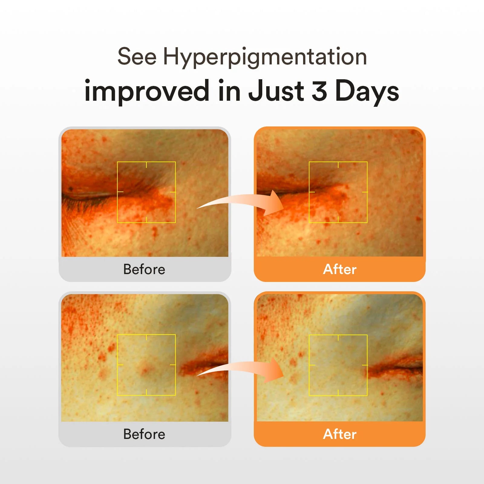 Abib Glutathiosome Dark Spot Serum Vita Drop 50 ml