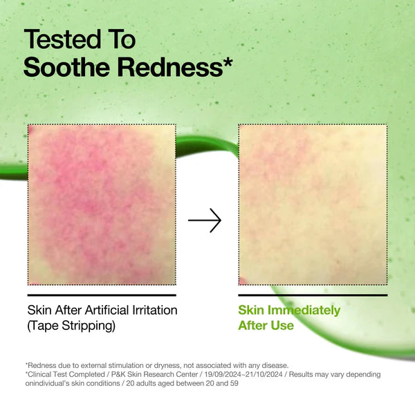 Anua Azelaic Acid 10 Hyaluron Redness Soothing Serum 30 ml / 1.0 oz