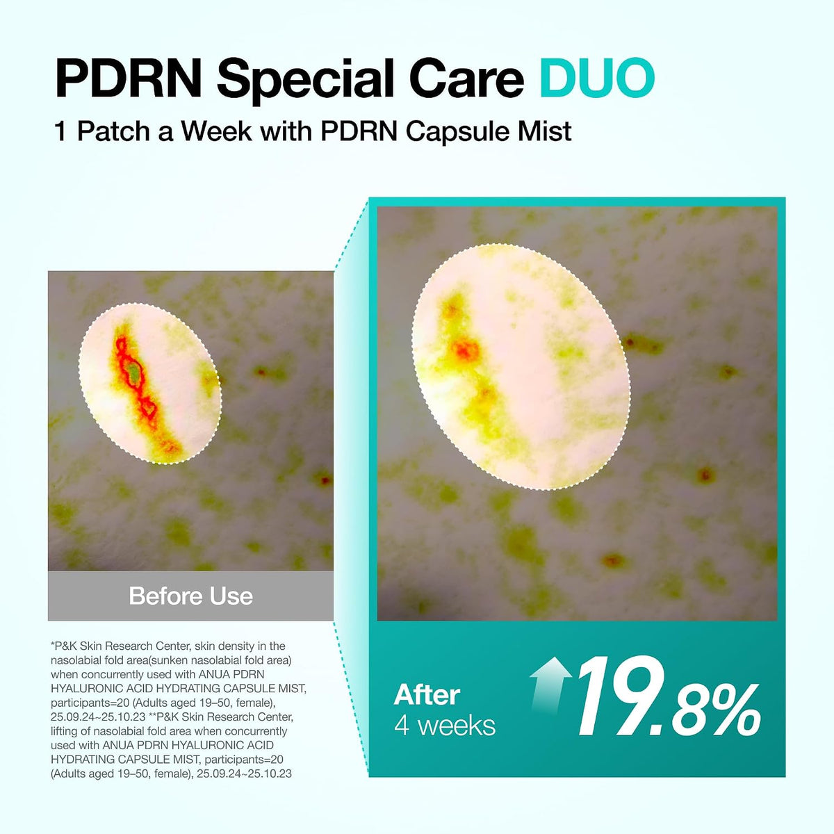 Anua PDRN Collagen Melting Patch For Glass Skin (4 ea)