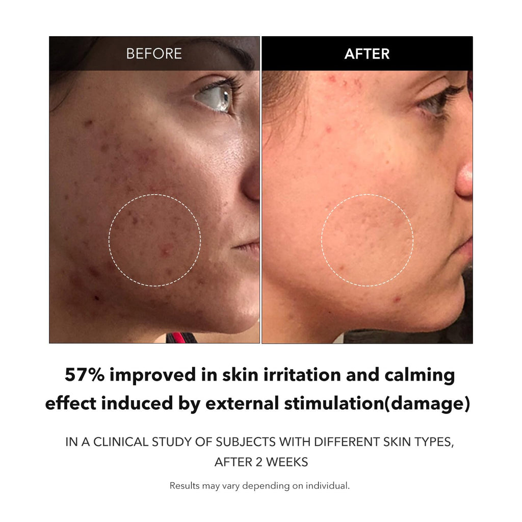 Aprilskin Carrotene Clarifying Serum 37 ml