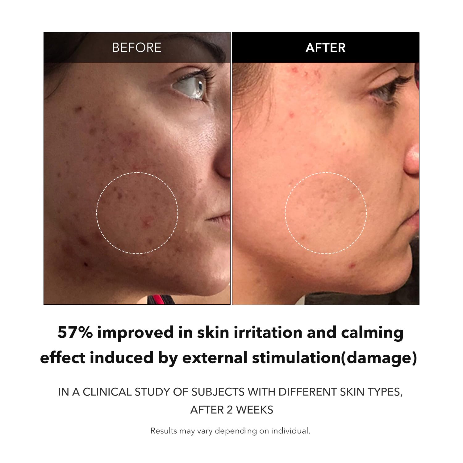 Aprilskin Carrotene Clarifying Serum 37 ml