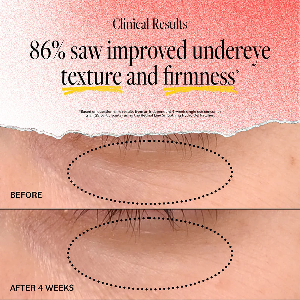 Derma E Retinol Line Smoothing Hydro Gel Patches (1 ea)