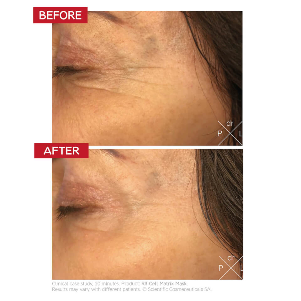 Dr. Levy R3 Cell Matrix Mask 50 ml