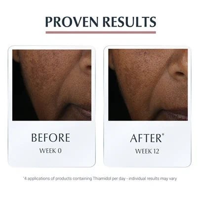 Eucerin Anti Pigment Spot Corrector 5 ml