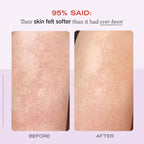 First Aid Beauty KP Bump Eraser Body Scrub with 10% AHA Fresh Strawberry Mini 1 oz / 28.3 g