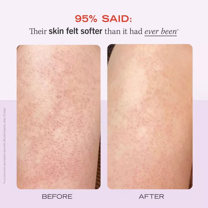 First Aid Beauty KP Bump Eraser Body Scrub with 10% AHA Fresh Strawberry Mini 1 oz / 28.3 g