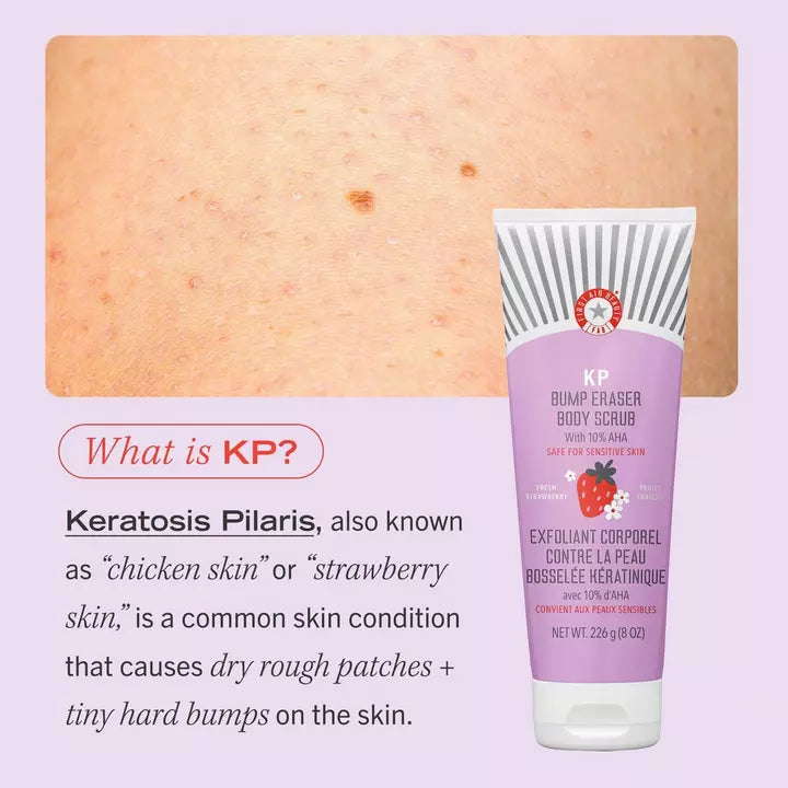 First Aid Beauty KP Bump Eraser Body Scrub with 10% AHA Fresh Strawberry Mini 1 oz / 28.3 g
