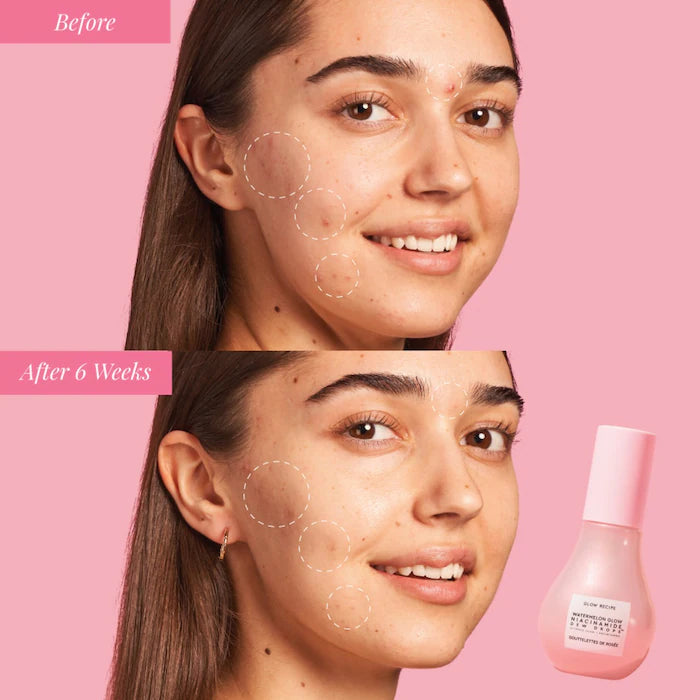 Glow Recipe Watermelon Glow Niacinamide Dew Drops No Box 15 ml