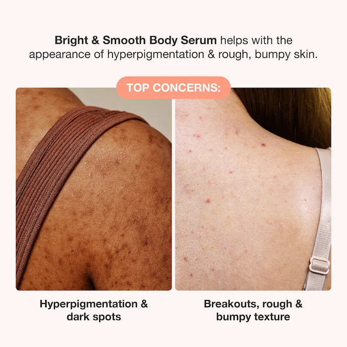 iNNBEAUTY PROJECT Body Bright & Smooth 7% AHA + BHA Body Serum 5 oz / 150 ml