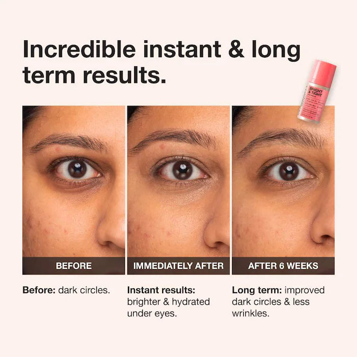 iNNBEAUTY PROJECT Bright & Tight Brightening Eye Cream 0.5 oz / 15 ml