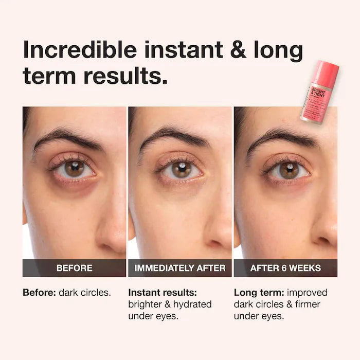 iNNBEAUTY PROJECT Bright & Tight Brightening Eye Cream 0.5 oz / 15 ml