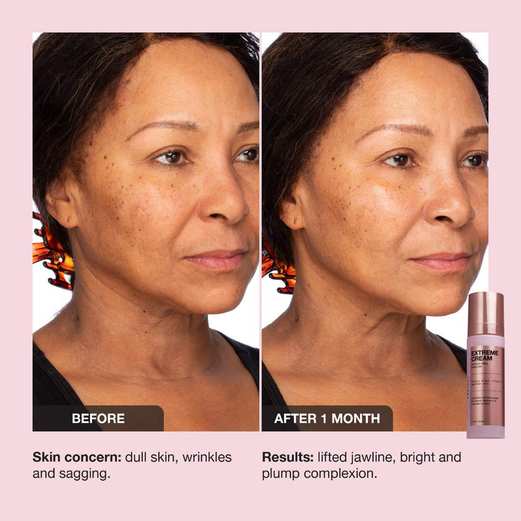 iNNBEAUTY PROJECT Extreme Cream Anti-Aging, Firming, & Lifting Refillable Moisturizer 50 ml