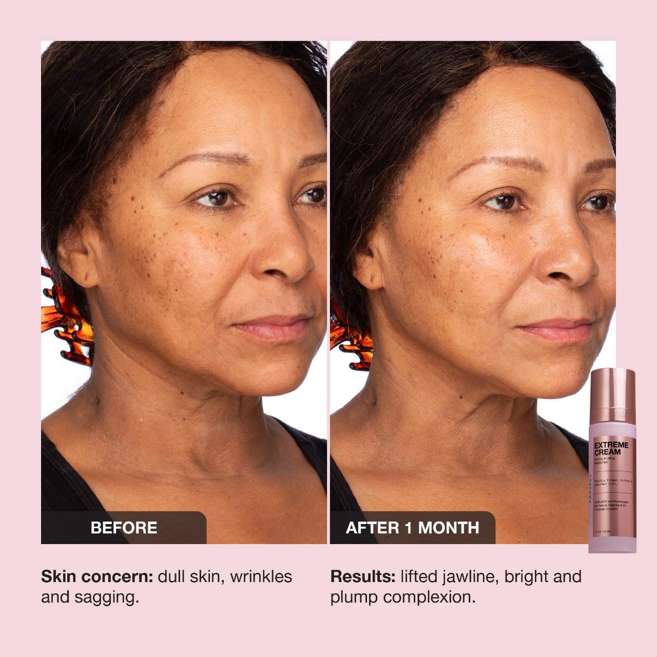 iNNBEAUTY PROJECT Extreme Cream Anti-Aging, Firming, & Lifting Refillable Moisturizer 50 ml