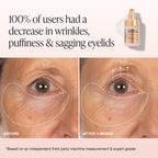 iNNBEAUTY PROJECT Extreme Cream Eye Firming & Contouring Eye Cream 15 ml / 0.5 oz