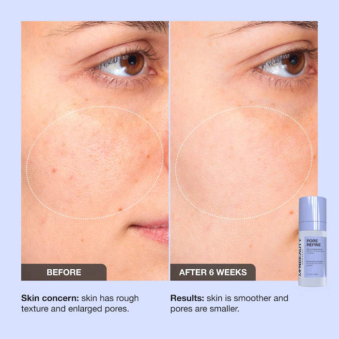 iNNBEAUTY PROJECT Pore Refine Pore & Texture Serum 1 oz / 30 ml