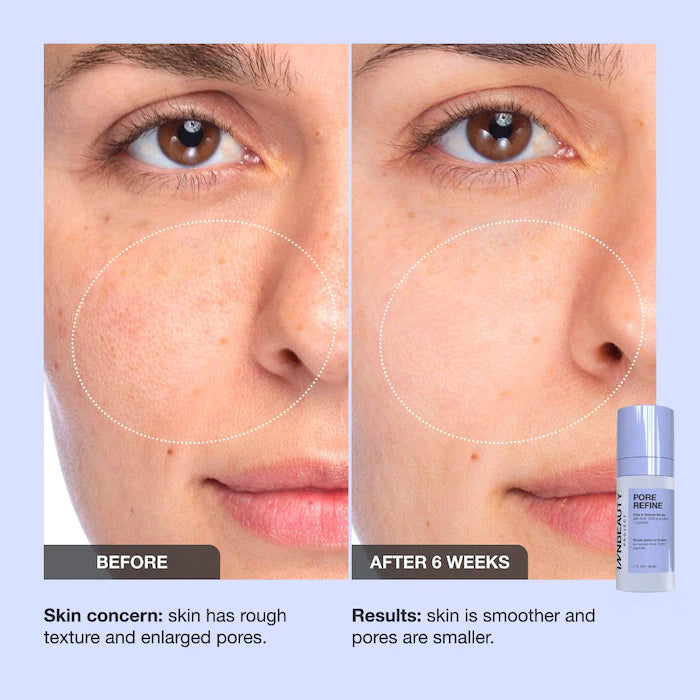 iNNBEAUTY PROJECT Pore Refine Pore & Texture Serum 1 oz / 30 ml