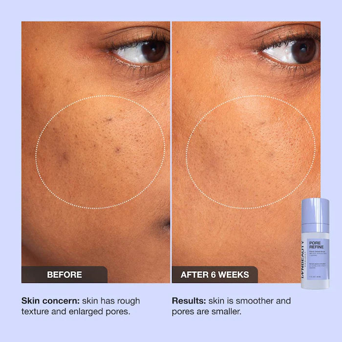 iNNBEAUTY PROJECT Pore Refine Pore & Texture Serum 1 oz / 30 ml