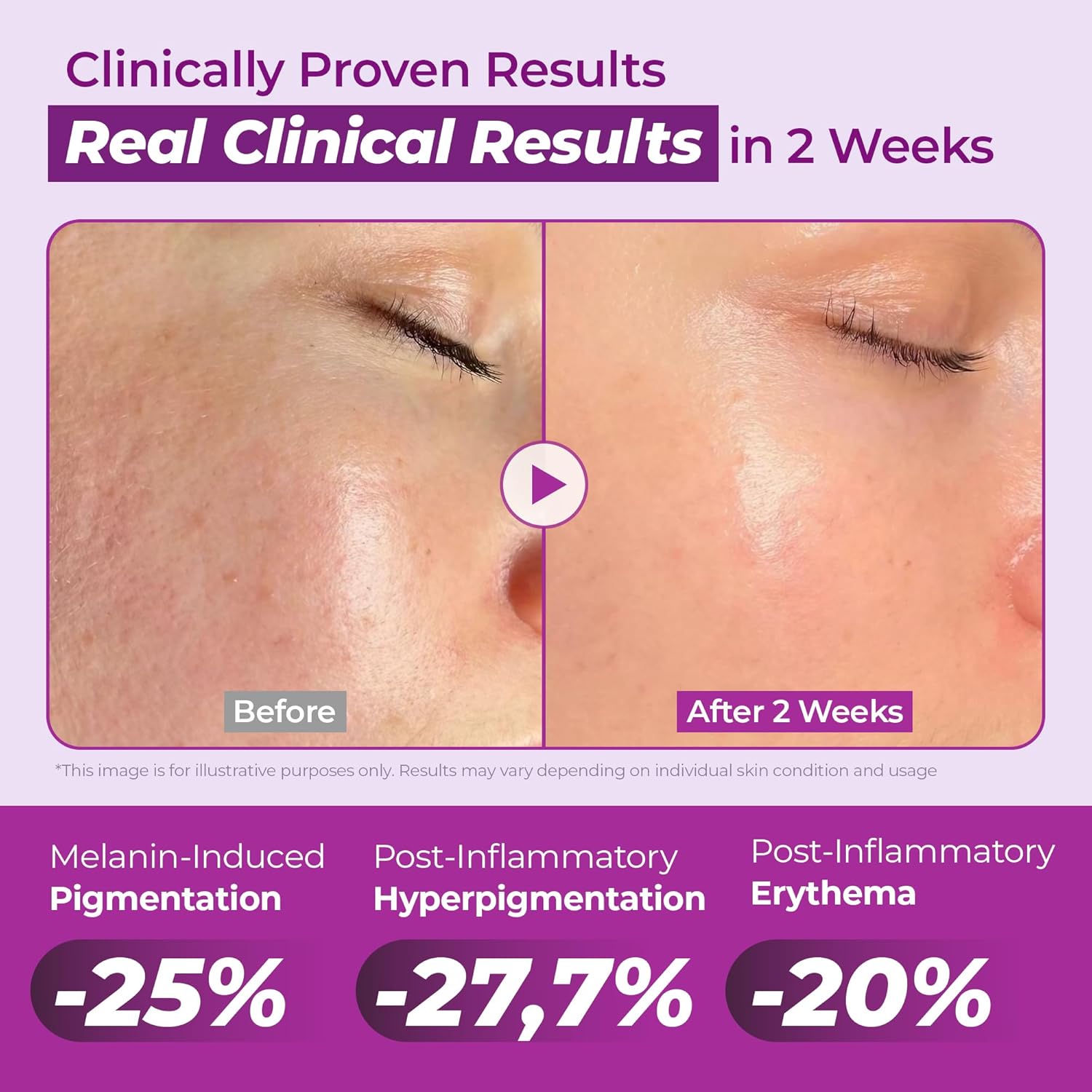 Jumiso Niacinamide 20 Serum 40 ml