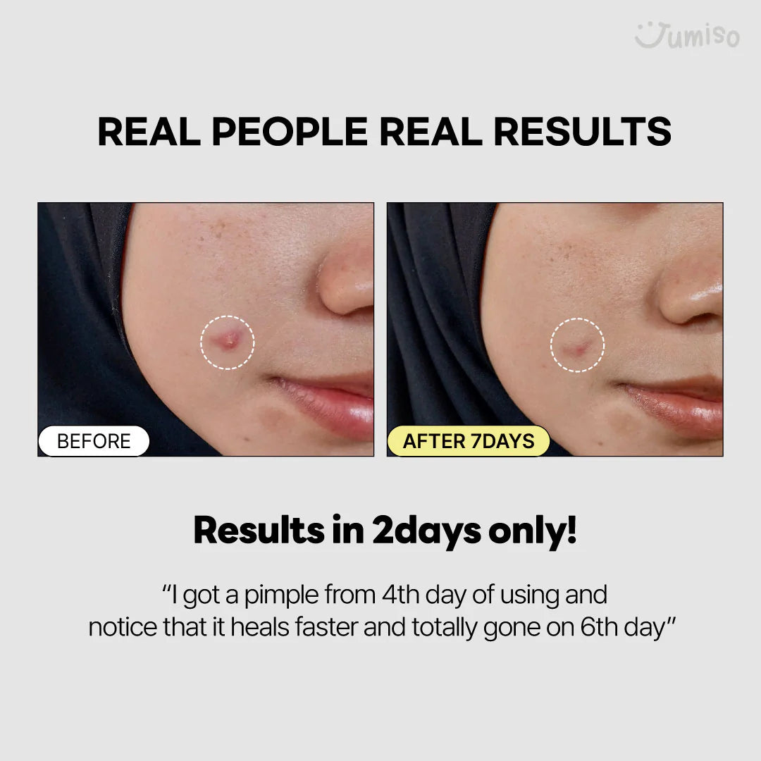 Jumiso Snail Mucin 95 + Peptide Essence 140 ml