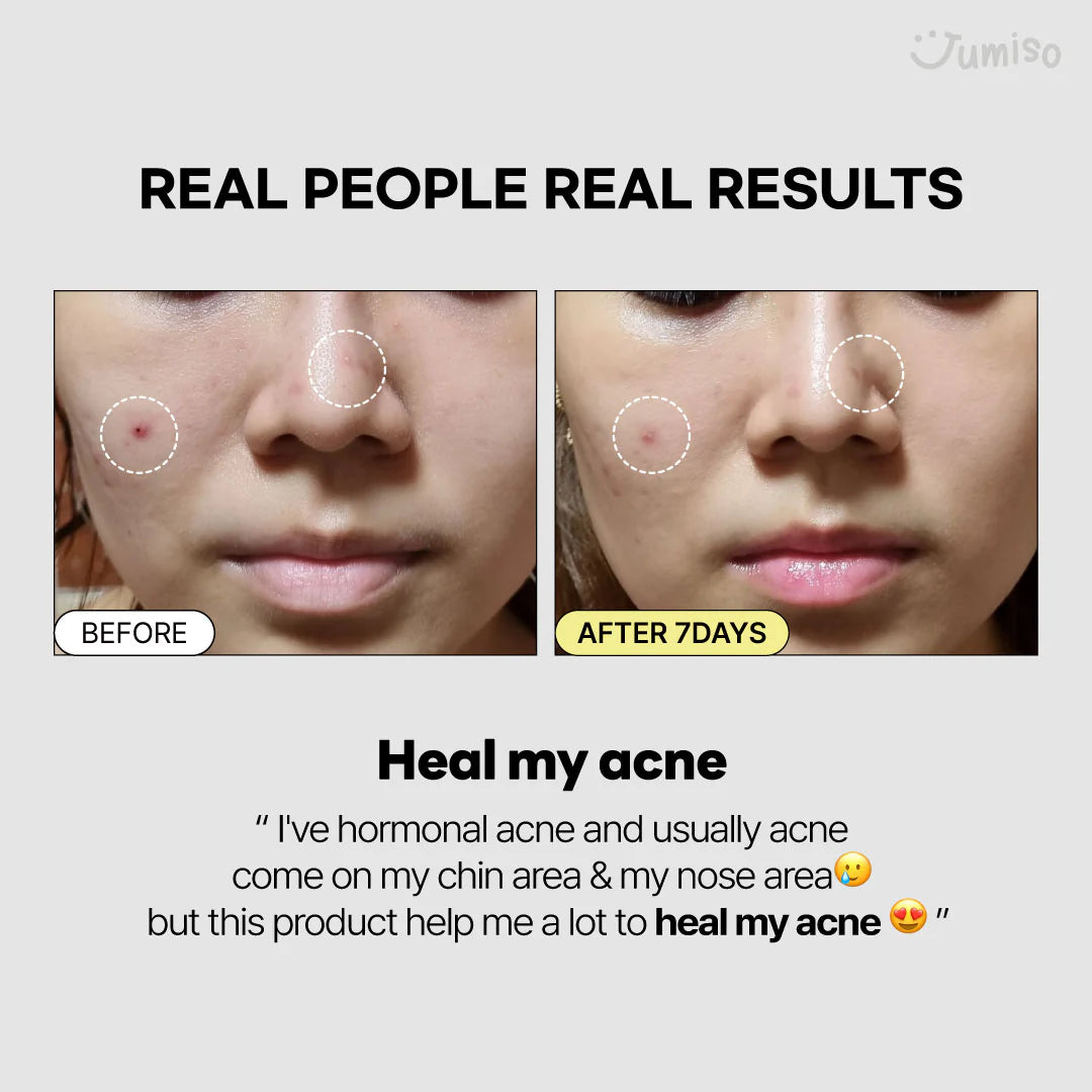 Jumiso Snail Mucin 95 + Peptide Essence 140 ml