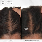 K18 FutureIQ™ Hair Longevity Serum 90 ml / 3.04 oz
