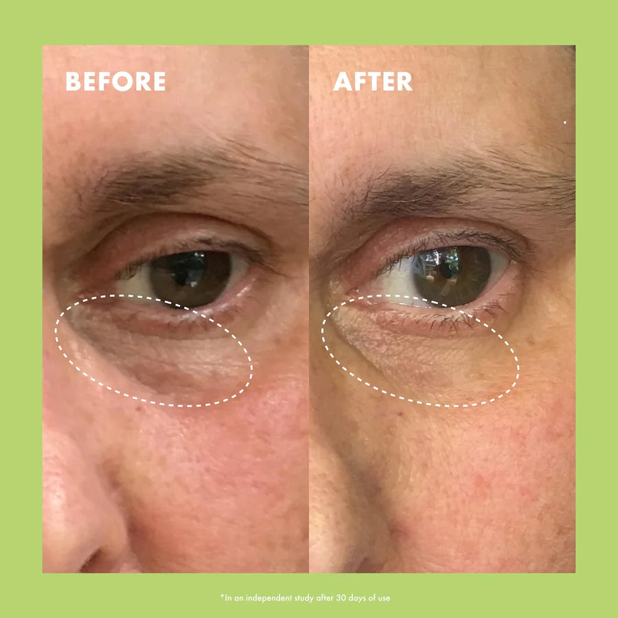 Kopari Niacinamide & caffeine Eye Bright Cream 15 g