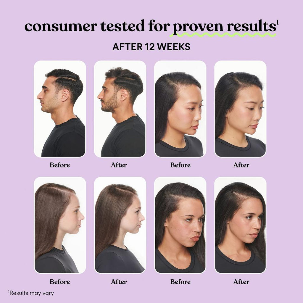 Lemme Grow Hair Growth & Anti-Shedding Capsules 60 Capsules