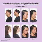 Lemme Grow Hair Growth & Anti-Shedding Capsules 60 Capsules