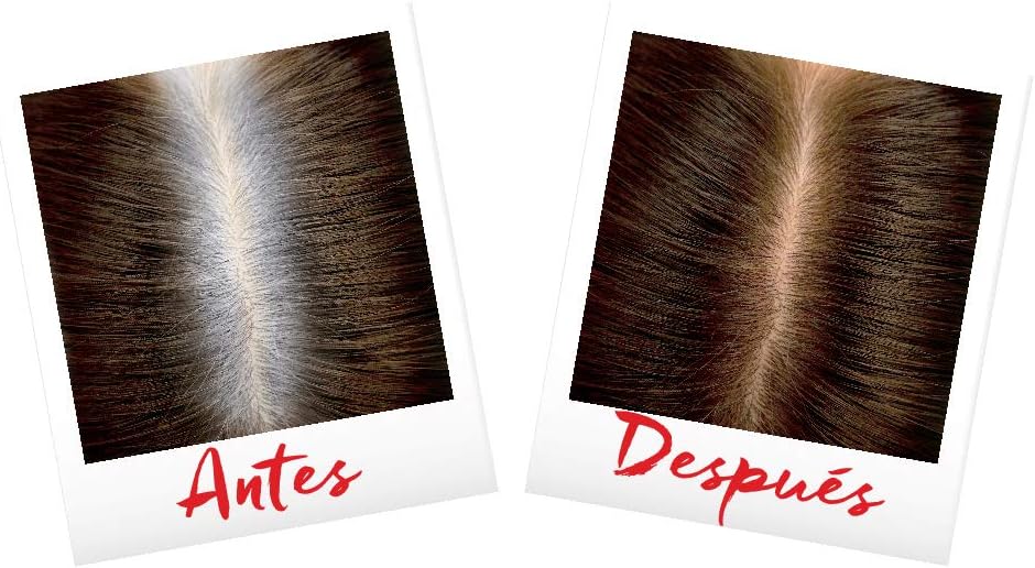 L'Oréal Magic Retouch 75 ml / 44 g