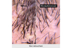 L'Oréal Professionnel Scalp Advanced Dandruff Shampoo 300 ml