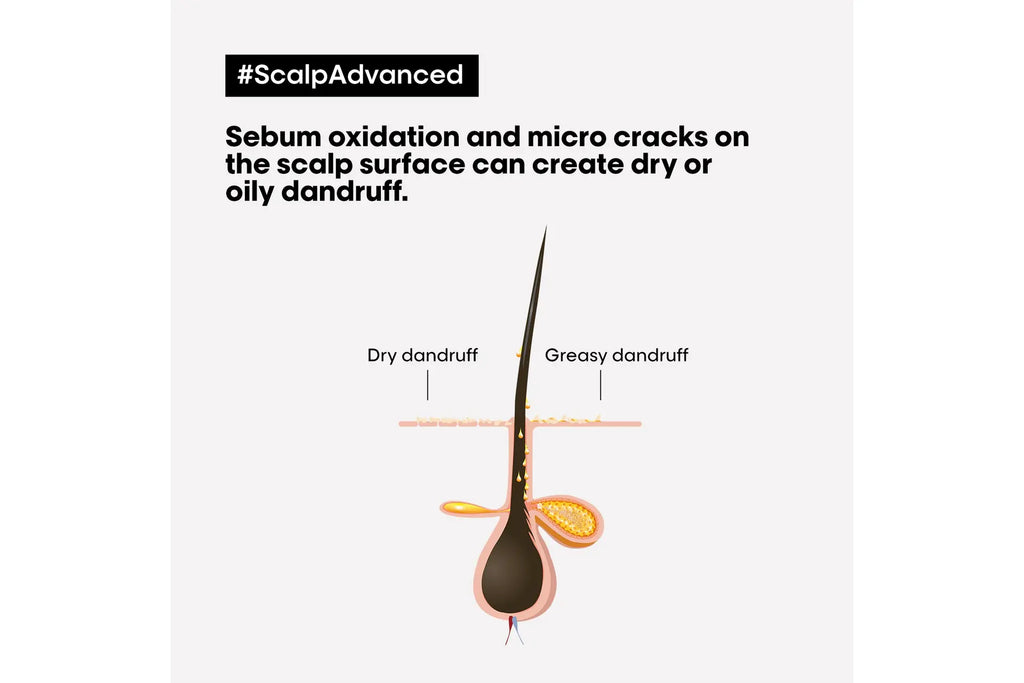 L'Oréal Professionnel Scalp Advanced Dandruff Shampoo 300 ml