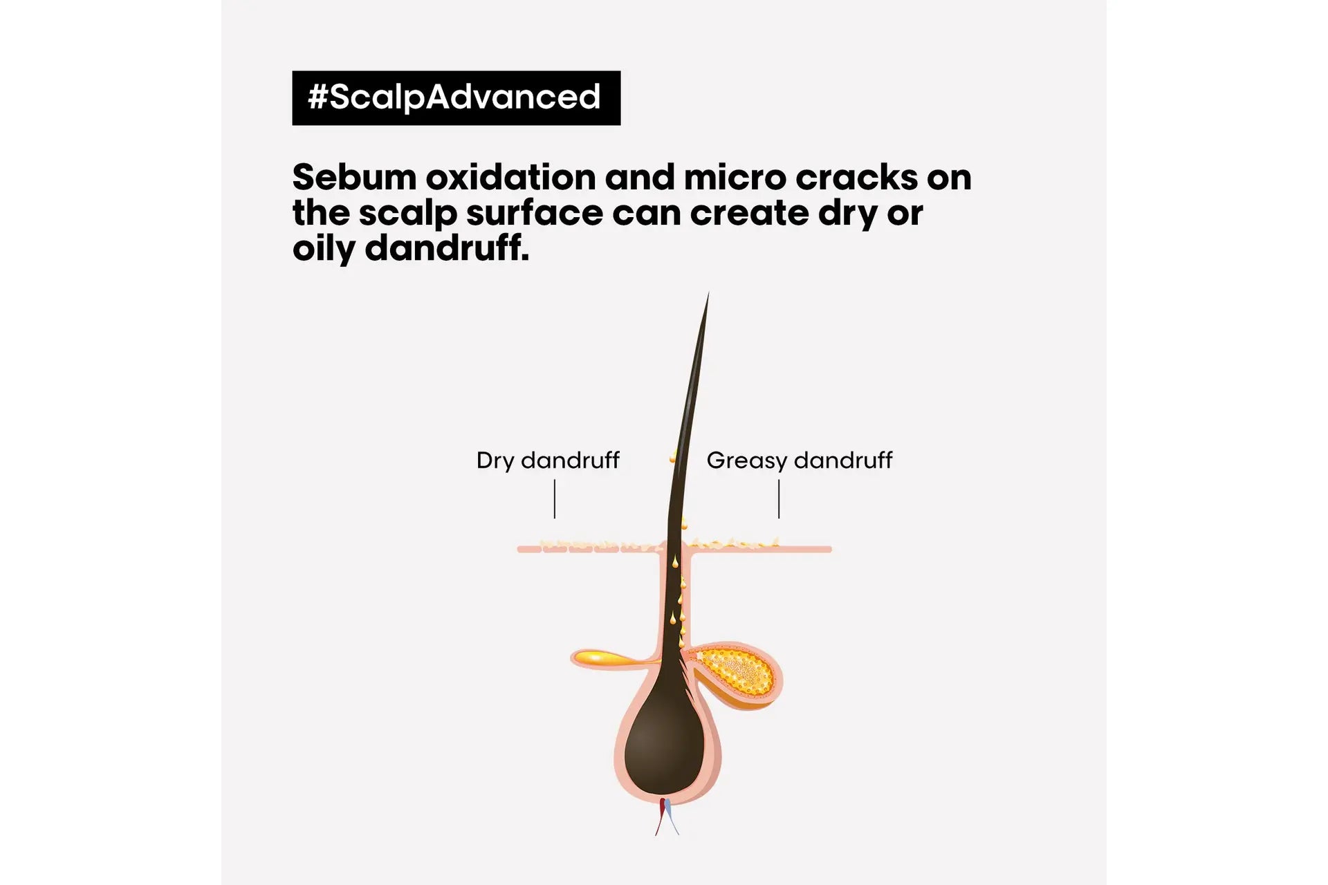 L'Oréal Professionnel Scalp Advanced Dandruff Shampoo 300 ml