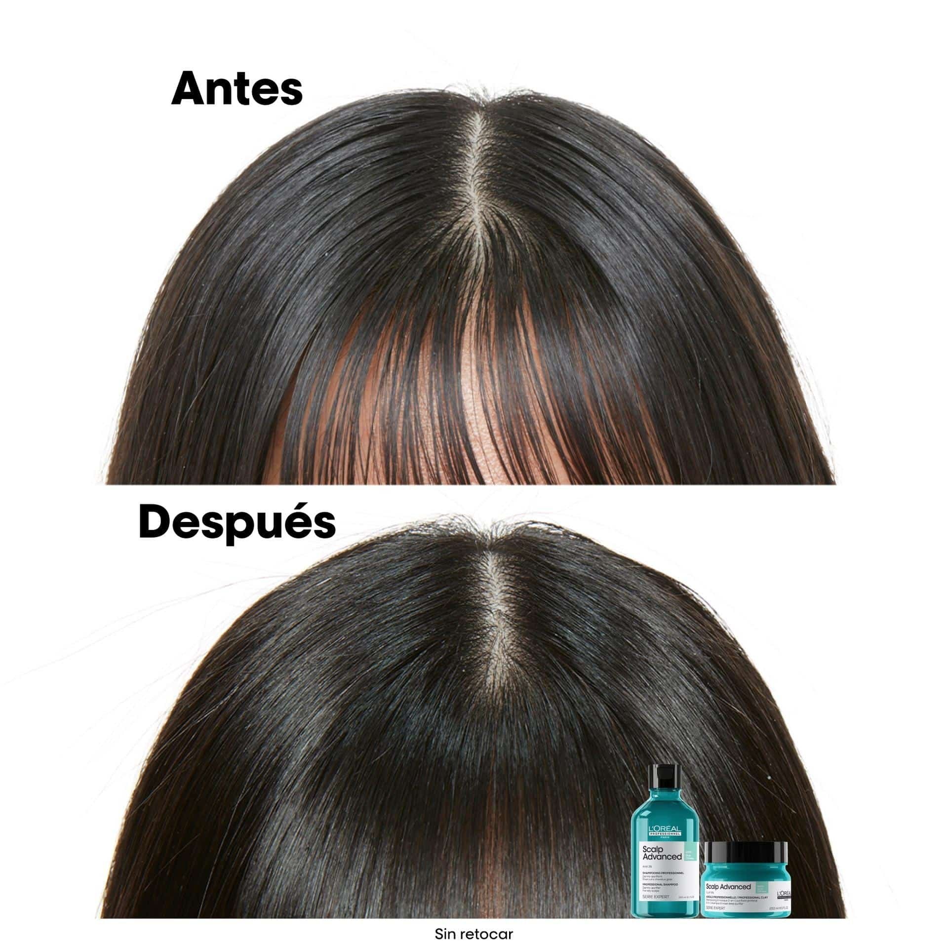 L'Oréal Professionnel Scalp Advanced Oiliness Shampoo 300 ml