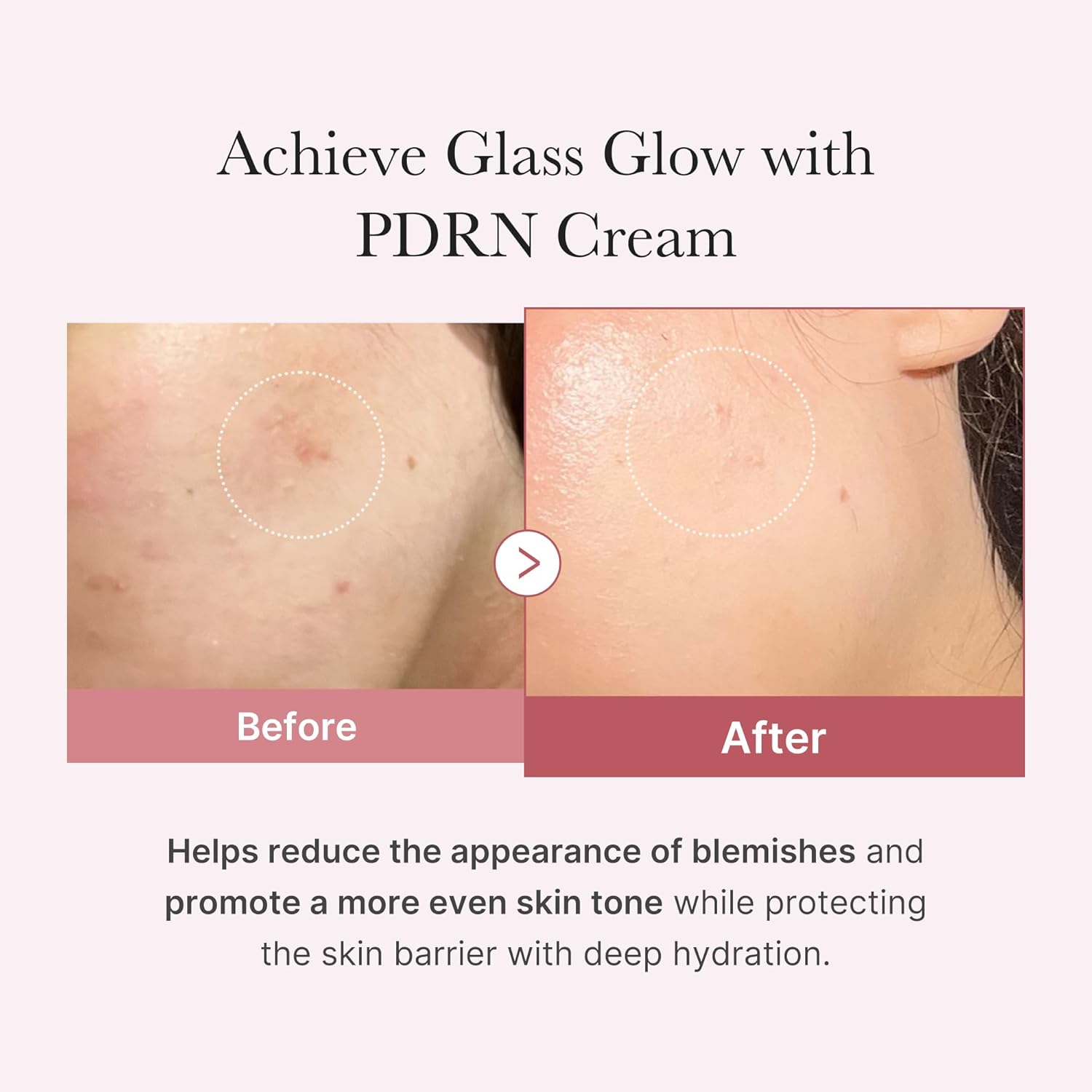 Medicube PDRN Pink Hyaluronic Moisturizing Cream 50 ml