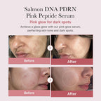 Medicube PDRN Pink Peptide Serum Mini 10 ml / 0.33 oz