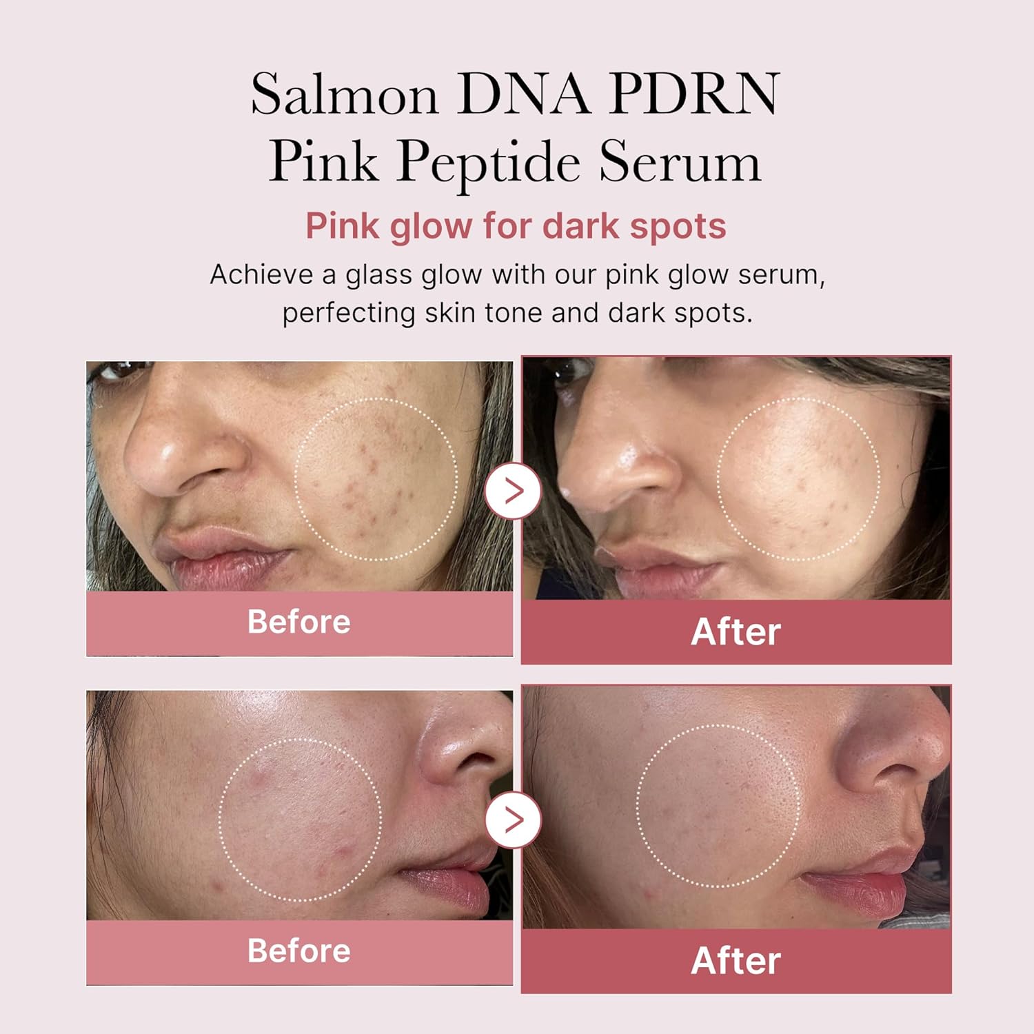 Medicube PDRN Pink Peptide Serum 30 ml / 1.01 oz