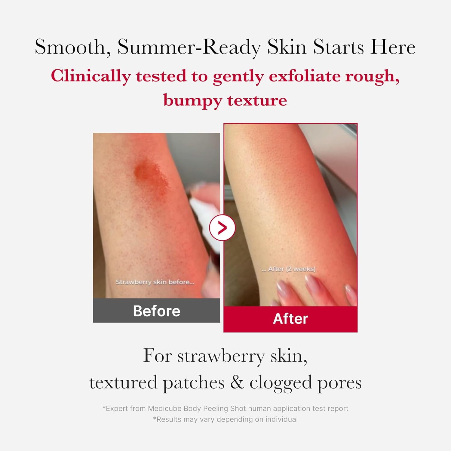 Medicube Red Body Peeling Shot Cleanser 110 g / 3.38 oz