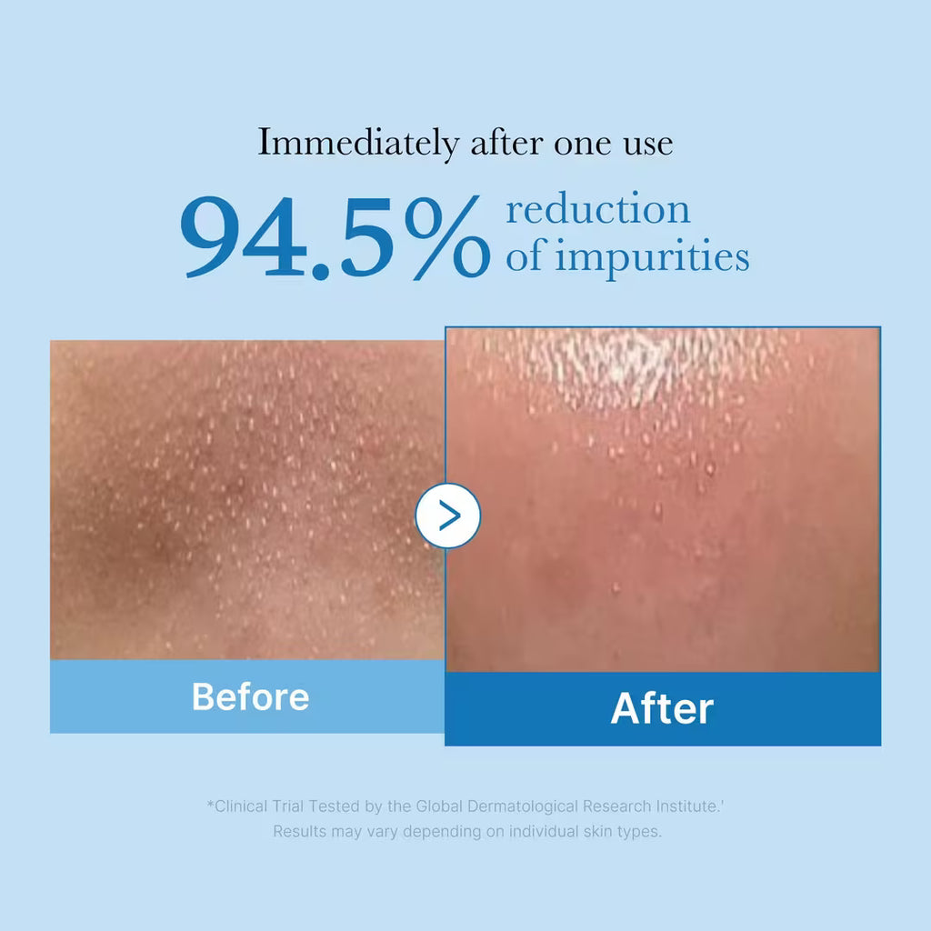 Medicube Zero Pore Blackhead Cleansing Oil 205 ml / 6.93 oz