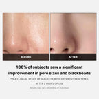 Medicube Zero Pore Pad 2.0 70 Pads
