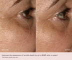 MZ Skin Soothe & Smooth Hyaluronic Brightening Eye Complex 14 ml