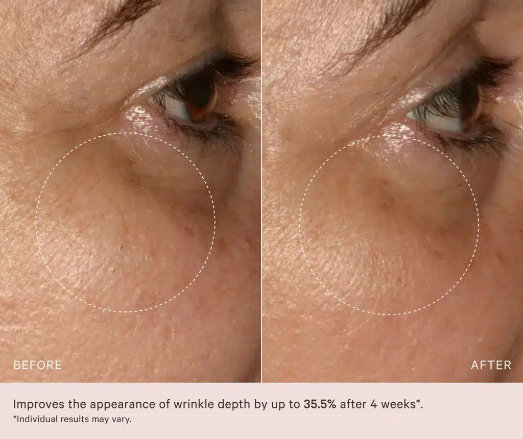 MZ Skin Soothe & Smooth Hyaluronic Brightening Eye Complex 14 ml