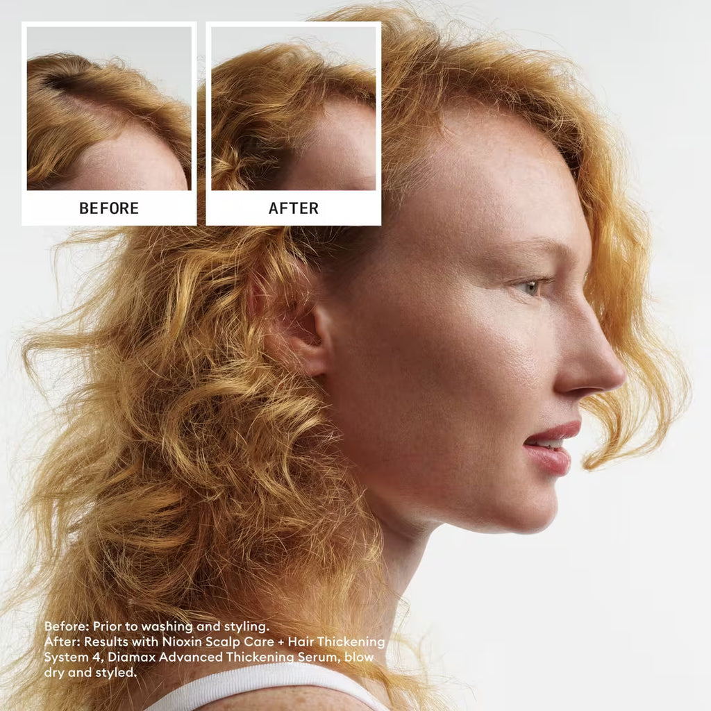 Nioxin Scalp + Hair Thickening System 4 Kit