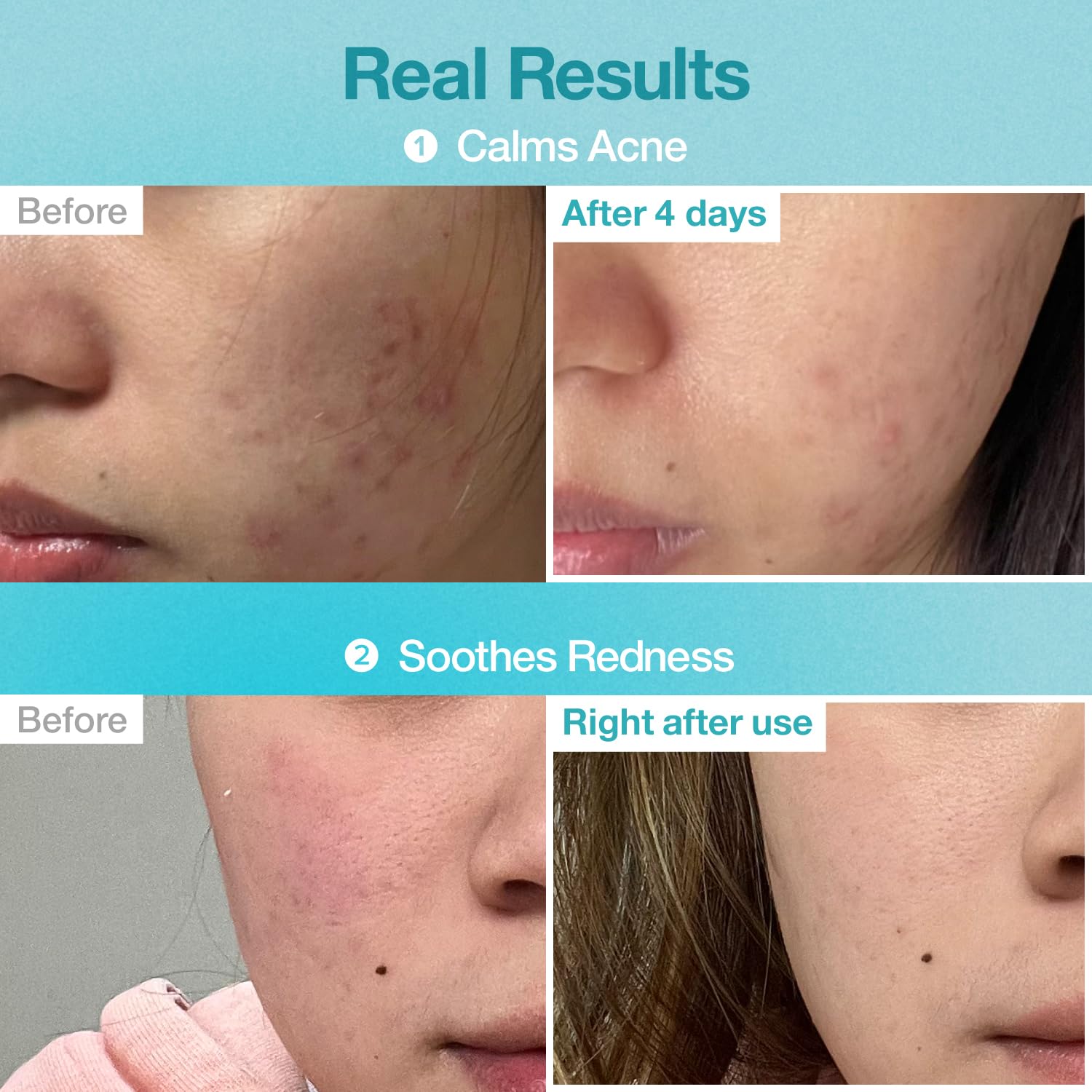 Numbuzin No.1 Pantothenic B5 Hyaluronic Active Clear Mask (5ea)