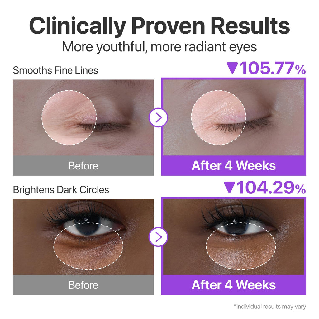 Numbuzin No.9 NAD Retinol Volumetox Eye Cream 10 ml