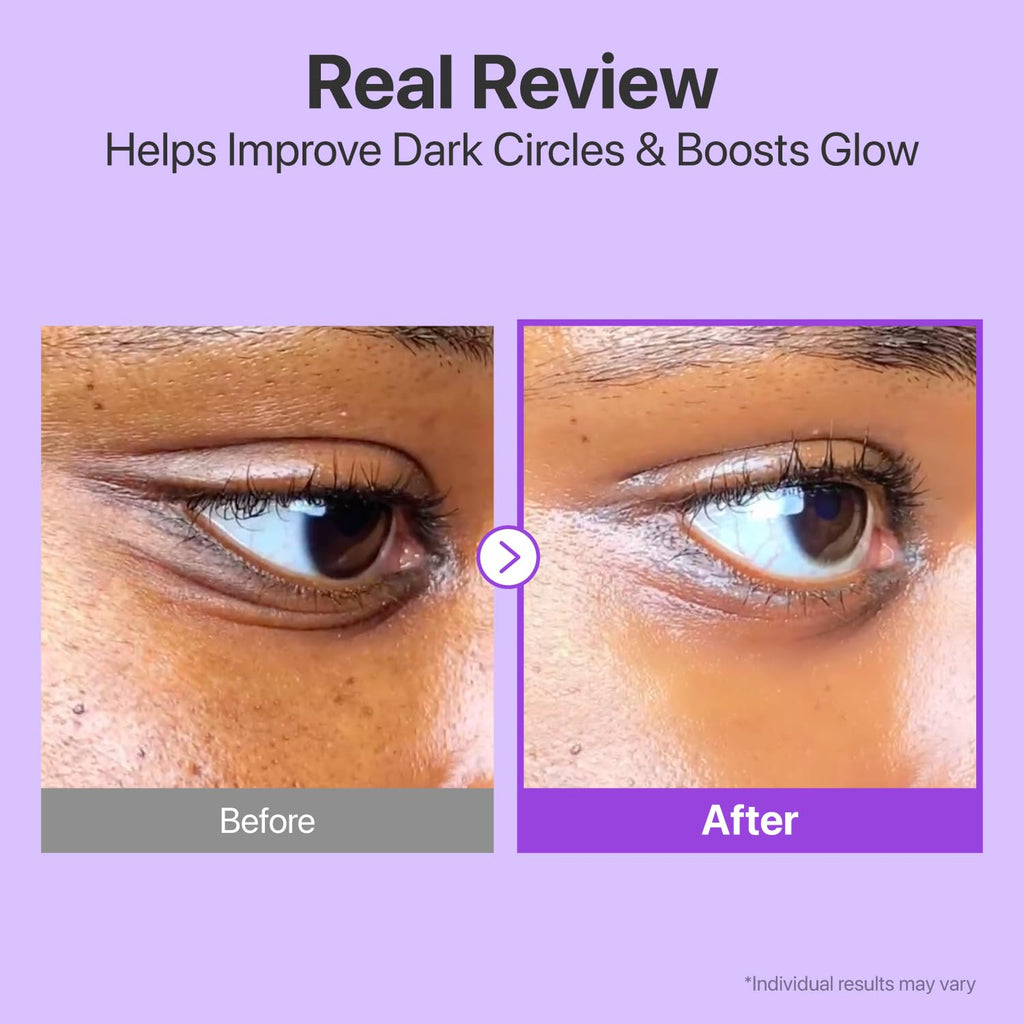 Numbuzin No.9 NAD Retinol Volumetox Eye Cream 10 ml