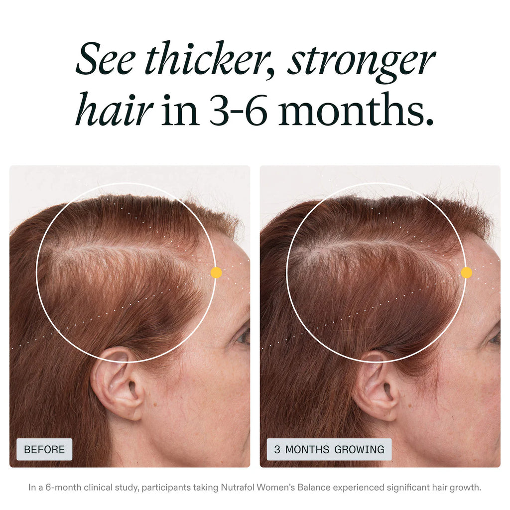 Nutrafol Women's Balance 45+ Hair Growth Supplements & Serum Gift Set for Thinning Hair