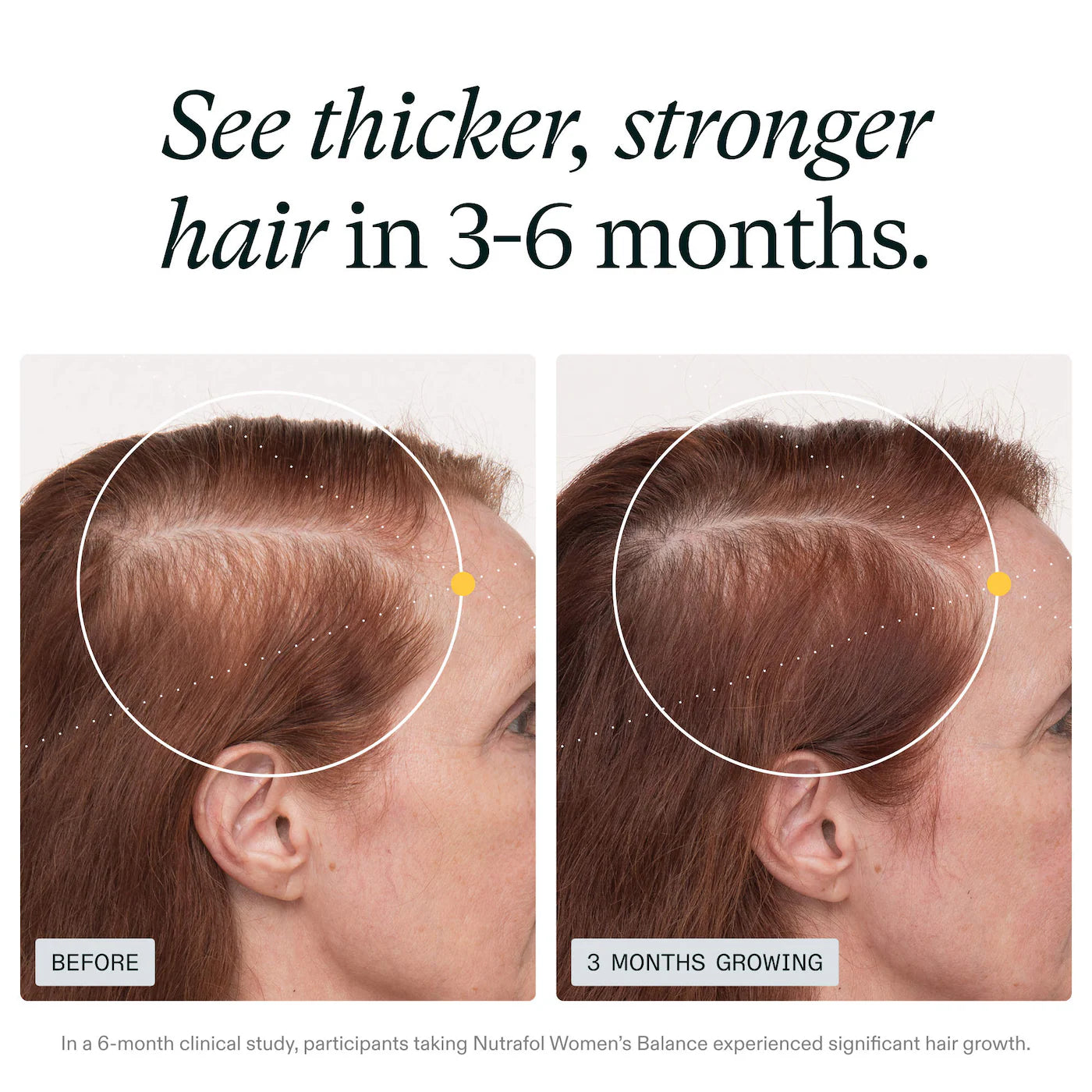 Nutrafol Women's Balance 45+ Hair Growth Supplements & Serum Gift Set for Thinning Hair