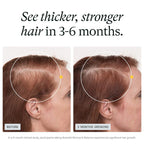 Nutrafol Women's Balance Hair Growth Nutraceutical 45+ Supplement 120 Cápsulas