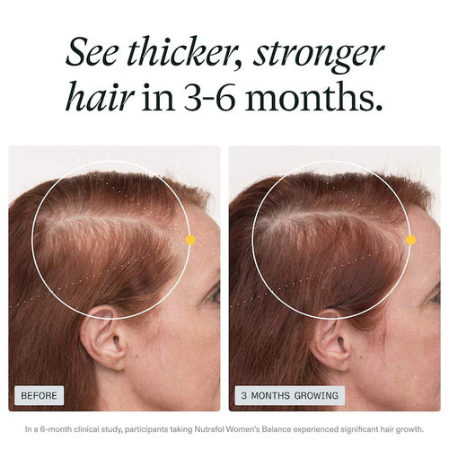 Nutrafol Women's Balance Hair Growth Nutraceutical 45+ Supplement 120 Cápsulas