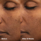Paula's Choice Skin Perfecting 6% Mandelic Acid + 2% Lactic Acid Liquid Exfoliant 88 ml